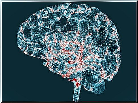 Huntington's disease - Characteristics and symptoms